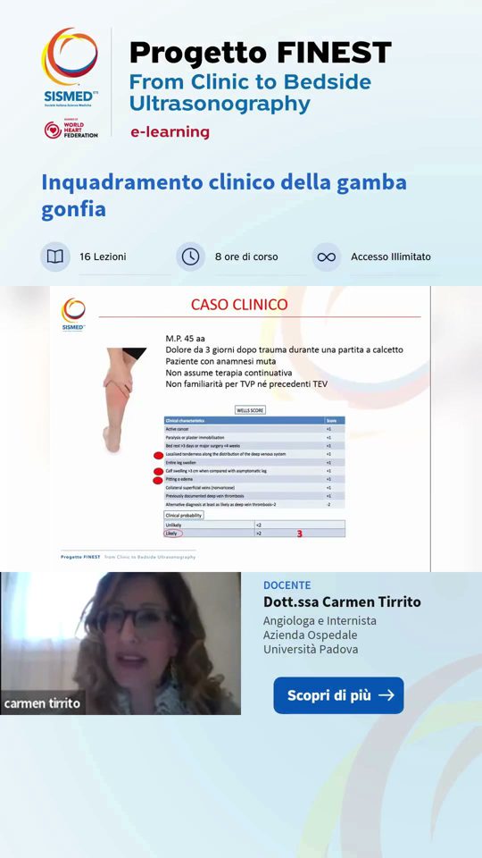 Gamba gonfia dopo calcetto: cosa fare in ambulatorio