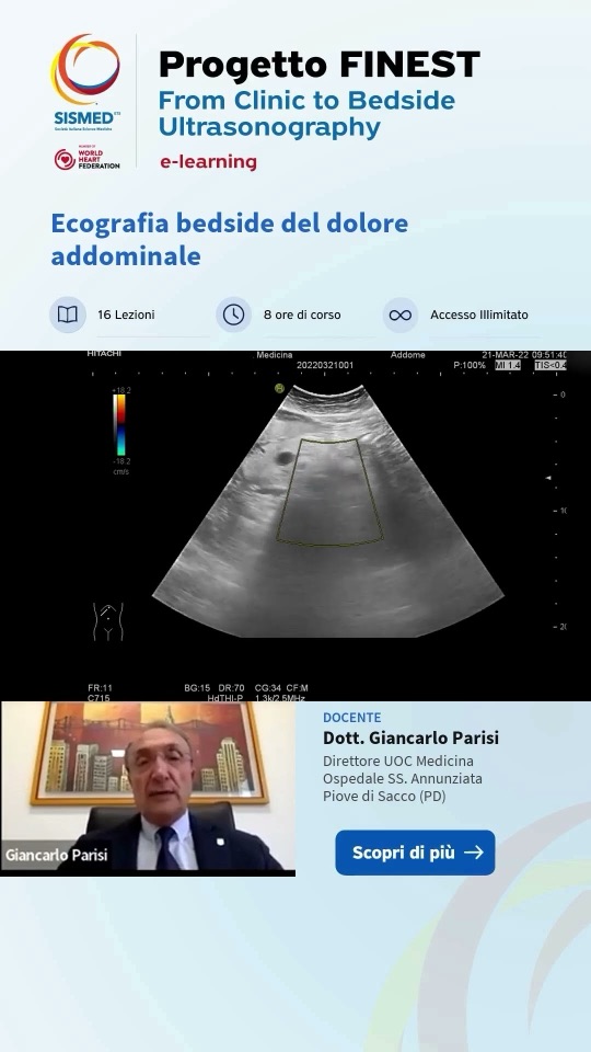 Sospetto alto di pancreatite acuta, confermato dall'ecografia a casa